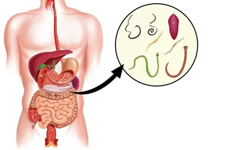 Vermixin